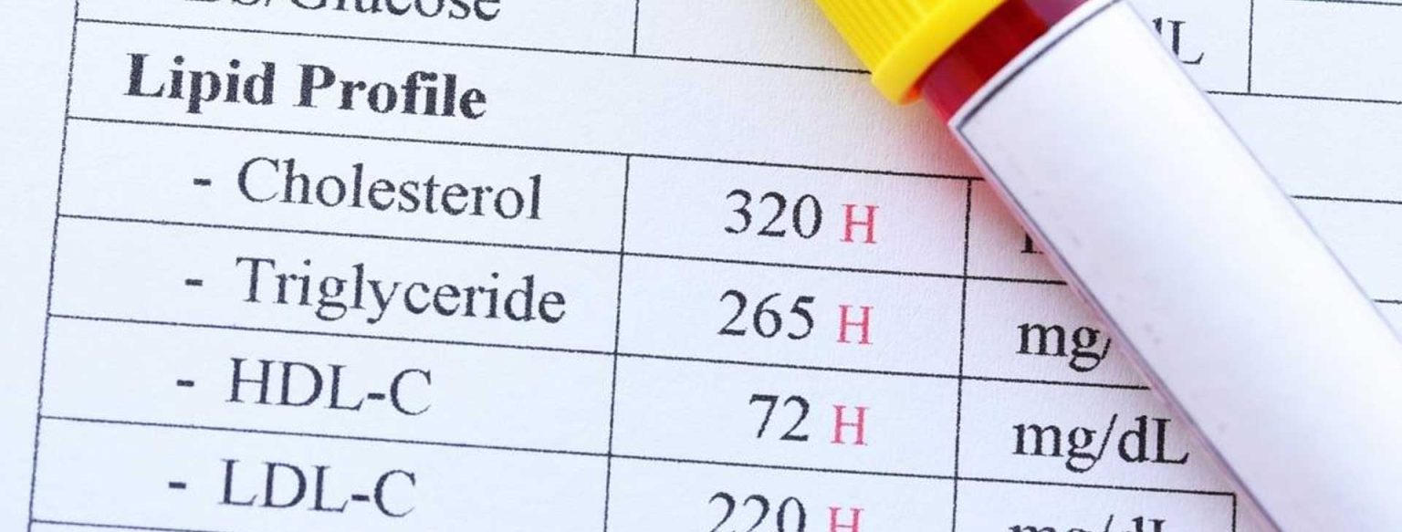 Lipid-Profile-banner