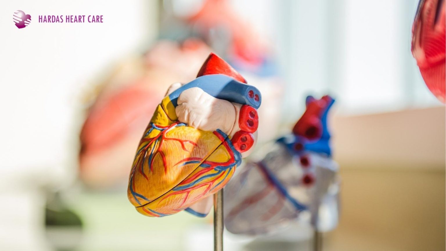 MINOCA (Myocardial Infarction with Non-Obstructive Coronary Arteries) - a heart attack without any blockage