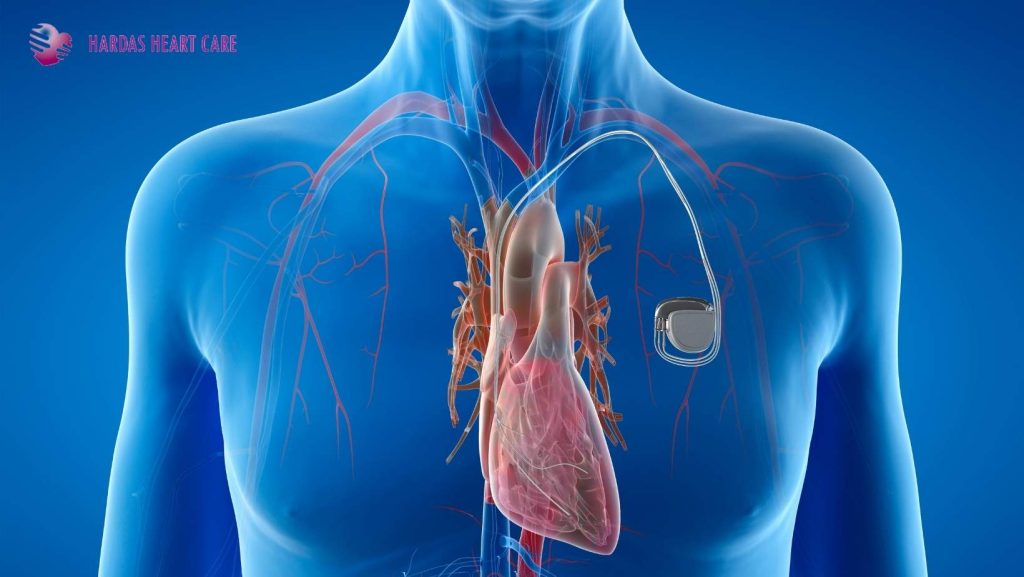 Discover key tips for pacemaker implantation in Pune. Dr. Suhas Hardas shares expert advice on care, safety, recovery, and living with a pacemaker