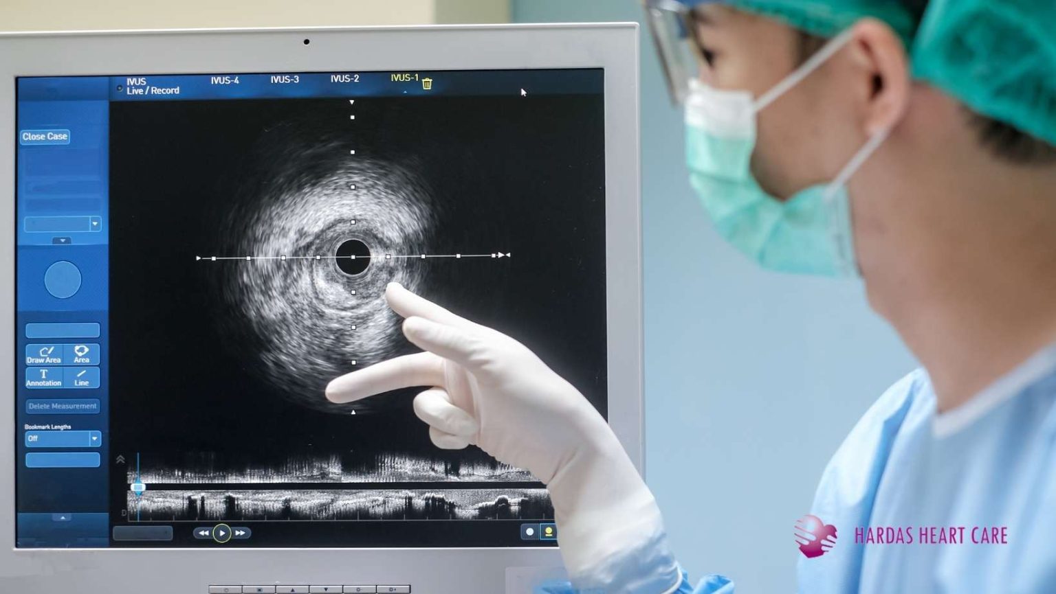 Illustration for cardiac catheterization specialist Pune showing a human heart and a close-up view of a catheter and stent inside a coronary artery.