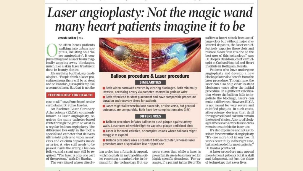 Newspaper article explaining laser angioplasty and why it is not a permanent cure for heart blockage